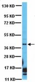 Anti-DAPK2 Antibody from rabbit, purified by affinity chromatography