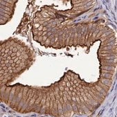 Anti-STUB1 antibody produced in rabbit Prestige Antibodies&#174; Powered by Atlas Antibodies, affinity isolated antibody, buffered aqueous glycerol solution