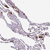 Anti-ARHGEF18 antibody produced in rabbit Prestige Antibodies&#174; Powered by Atlas Antibodies, affinity isolated antibody, buffered aqueous glycerol solution