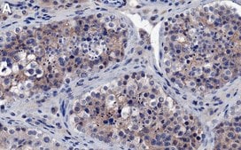 Anti-PI3 Kinase p110 β Antibody, clone 1D18 ZooMAb® Rabbit Monoclonal recombinant, expressed in HEK 293 cells