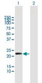 Anti-MYL5 antibody produced in mouse purified immunoglobulin, buffered aqueous solution