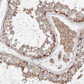 Anti-LZTS1 antibody produced in rabbit Prestige Antibodies® Powered by Atlas Antibodies, affinity isolated antibody, buffered aqueous glycerol solution