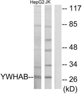 Anti-14-3-3 &#946; antibody produced in rabbit affinity isolated antibody