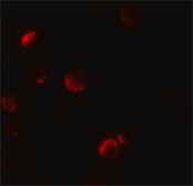 Anti-YPEL1 antibody produced in rabbit affinity isolated antibody