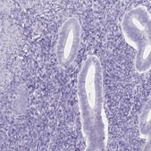 Anti-UBQLN3 antibody produced in rabbit Prestige Antibodies® Powered by Atlas Antibodies, affinity isolated antibody, buffered aqueous glycerol solution