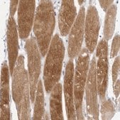 Anti-TMOD4 antibody produced in rabbit Prestige Antibodies&#174; Powered by Atlas Antibodies, affinity isolated antibody, buffered aqueous glycerol solution