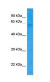 Anti-SLC39A4 antibody produced in rabbit affinity isolated antibody