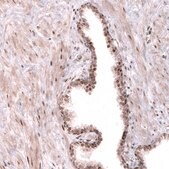Anti-TNRC6A antibody produced in rabbit Prestige Antibodies&#174; Powered by Atlas Antibodies, affinity isolated antibody, buffered aqueous glycerol solution
