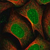 Anti-NUP155 antibody produced in rabbit Prestige Antibodies® Powered by Atlas Antibodies, affinity isolated antibody, buffered aqueous glycerol solution