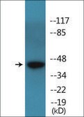 Anti-phospho-p53 (pSer15) antibody produced in rabbit affinity isolated antibody