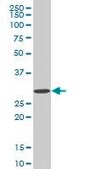 Monoclonal Anti-SIX3, (C-terminal) antibody produced in mouse clone 3F1, purified immunoglobulin, buffered aqueous solution