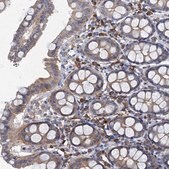 Anti-TPCN1 antibody produced in rabbit Prestige Antibodies® Powered by Atlas Antibodies, affinity isolated antibody, buffered aqueous glycerol solution