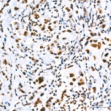 Anti-SUMO2/3 Antibody, clone 6R8G7, Rabbit Monoclonal