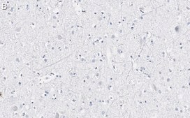 Anti-VGLUT2 Antibody, clone 8G9.2 ZooMAb&#174; Mouse Monoclonal recombinant, expressed in HEK 293 cells
