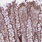 Anti-TMEM39A antibody produced in rabbit Prestige Antibodies&#174; Powered by Atlas Antibodies, affinity isolated antibody, buffered aqueous glycerol solution