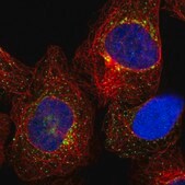 Anti-TMEM87B antibody produced in rabbit Prestige Antibodies® Powered by Atlas Antibodies, affinity isolated antibody, buffered aqueous glycerol solution