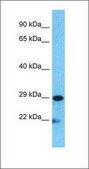 Anti-MUC1 affinity isolated antibody