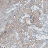 Anti-NOX4 antibody produced in rabbit Prestige Antibodies&#174; Powered by Atlas Antibodies, affinity isolated antibody, buffered aqueous glycerol solution