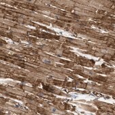 Anti-PALMD antibody produced in rabbit Prestige Antibodies&#174; Powered by Atlas Antibodies, affinity isolated antibody, buffered aqueous glycerol solution