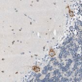 Anti-B4GALNT1 antibody produced in rabbit Ab1, Prestige Antibodies&#174; Powered by Atlas Antibodies, affinity isolated antibody, buffered aqueous glycerol solution