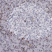Anti-WAS antibody produced in rabbit Prestige Antibodies® Powered by Atlas Antibodies, affinity isolated antibody, buffered aqueous glycerol solution