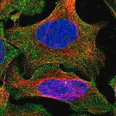 Anti-ENKD1 antibody produced in rabbit Prestige Antibodies® Powered by Atlas Antibodies, affinity isolated antibody, buffered aqueous glycerol solution