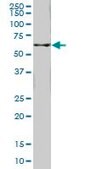 Monoclonal Anti-FTCD, (C-terminal) antibody produced in mouse clone 5F6, purified immunoglobulin, buffered aqueous solution