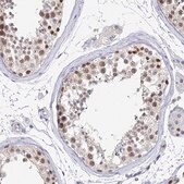 Anti-MCM2 antibody produced in rabbit Prestige Antibodies&#174; Powered by Atlas Antibodies, affinity isolated antibody, buffered aqueous glycerol solution