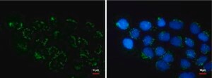Monoclonal Anti-COL11A2 antibody produced in mouse clone GT473, affinity isolated antibody