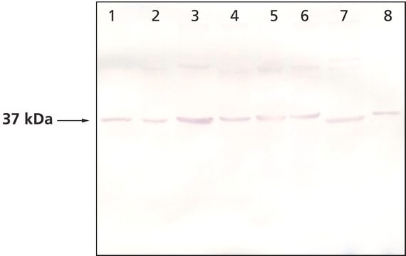 Monoclonal Anti-PINCH-1 antibody produced in mouse clone PINCH-C58, purified immunoglobulin, buffered aqueous solution
