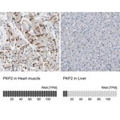 Anti-PKP2 antibody produced in rabbit Prestige Antibodies® Powered by Atlas Antibodies, affinity isolated antibody, buffered aqueous glycerol solution