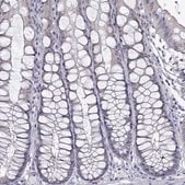 Anti-PADI1 antibody produced in rabbit Prestige Antibodies&#174; Powered by Atlas Antibodies, affinity isolated antibody, buffered aqueous glycerol solution