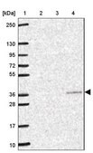 Anti-YIF1B antibody produced in rabbit Prestige Antibodies&#174; Powered by Atlas Antibodies, affinity isolated antibody, buffered aqueous glycerol solution