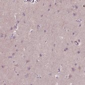 Anti-PKP3 antibody produced in rabbit Prestige Antibodies&#174; Powered by Atlas Antibodies, affinity isolated antibody, buffered aqueous glycerol solution