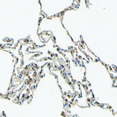 Anti-PDGFB antibody produced in rabbit Prestige Antibodies® Powered by Atlas Antibodies, affinity isolated antibody, buffered aqueous glycerol solution