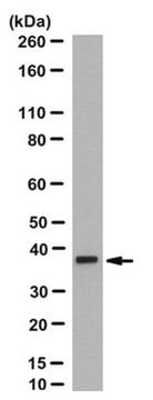 Anti-Anoctamin-5 Antibody, clone 5F7 clone 5F7, from mouse