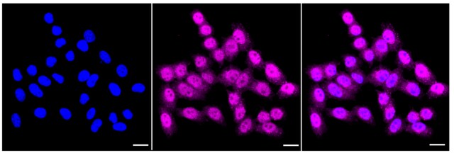 Anti BRAT1 Antibody, clone 23GB4355, Rabbit Monoclonal clone 23GB4355, recombinant rabbit monoclonal, expressed in HEK293 cells