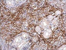 Anti-ITIH3 antibody produced in rabbit affinity isolated antibody, buffered aqueous solution