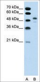 Anti-POU3F2 (AB2) antibody produced in rabbit affinity isolated antibody