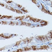 Anti-Phospho-Erk1-T202/Y204 + Erk2-T185/Y187 antibody produced in rabbit