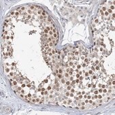 Anti-LEXM antibody produced in rabbit Prestige Antibodies&#174; Powered by Atlas Antibodies, affinity isolated antibody, buffered aqueous glycerol solution