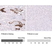 Monoclonal Anti-PVALB antibody produced in mouse Prestige Antibodies® Powered by Atlas Antibodies, clone CL15070, purified antibody (Protein A)