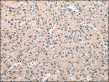 Anti-WDR5 affinity isolated antibody