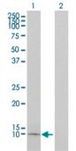 Monoclonal Anti-APOC1 antibody produced in mouse clone 2E2-1A3, purified immunoglobulin, buffered aqueous solution