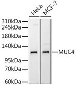 Anti-MUC4 Antibody, clone 5J3R7, Rabbit Monoclonal