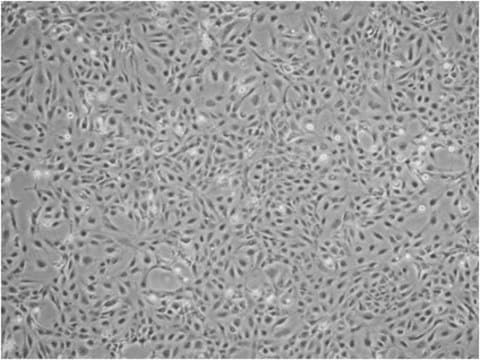 LX-2 Human Hepatic Stellate Cell Line The LX-2 human hepatic stellate cell line has been extensively characterized and retain key features of hepatic stellate cytokine signaling, neuronal gene expression, retinoid metabolism, and fibrogenesis, making them a highly suitable model of human hepatic fibrosis.