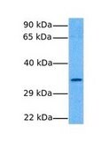 Anti-FOXF1 (AB2) antibody produced in rabbit IgG fraction of antiserum