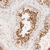 抗-RPGR 兔抗 Prestige Antibodies&#174; Powered by Atlas Antibodies, affinity isolated antibody, buffered aqueous glycerol solution