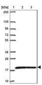 Anti-RPS17 antibody produced in rabbit Prestige Antibodies&#174; Powered by Atlas Antibodies, affinity isolated antibody, buffered aqueous glycerol solution
