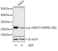 Anti-Phospho-HSP27/HSPB1-S82 antibody produced in rabbit